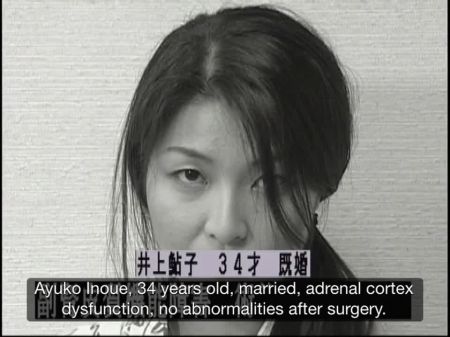 gyno mother daunther